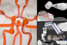 Remote-controlled robot can perform surgery in stroke patients